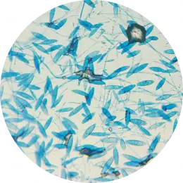 Microsporum gypseum