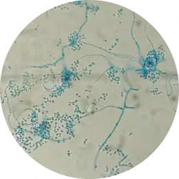 Trichophyton spp