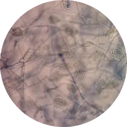 Fusarium spp