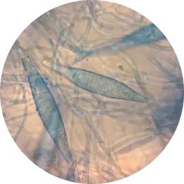 Microsporum canis