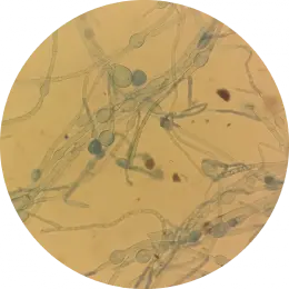 Trichophyton tonsurans