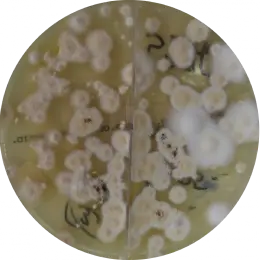 Trichophyton tonsurans