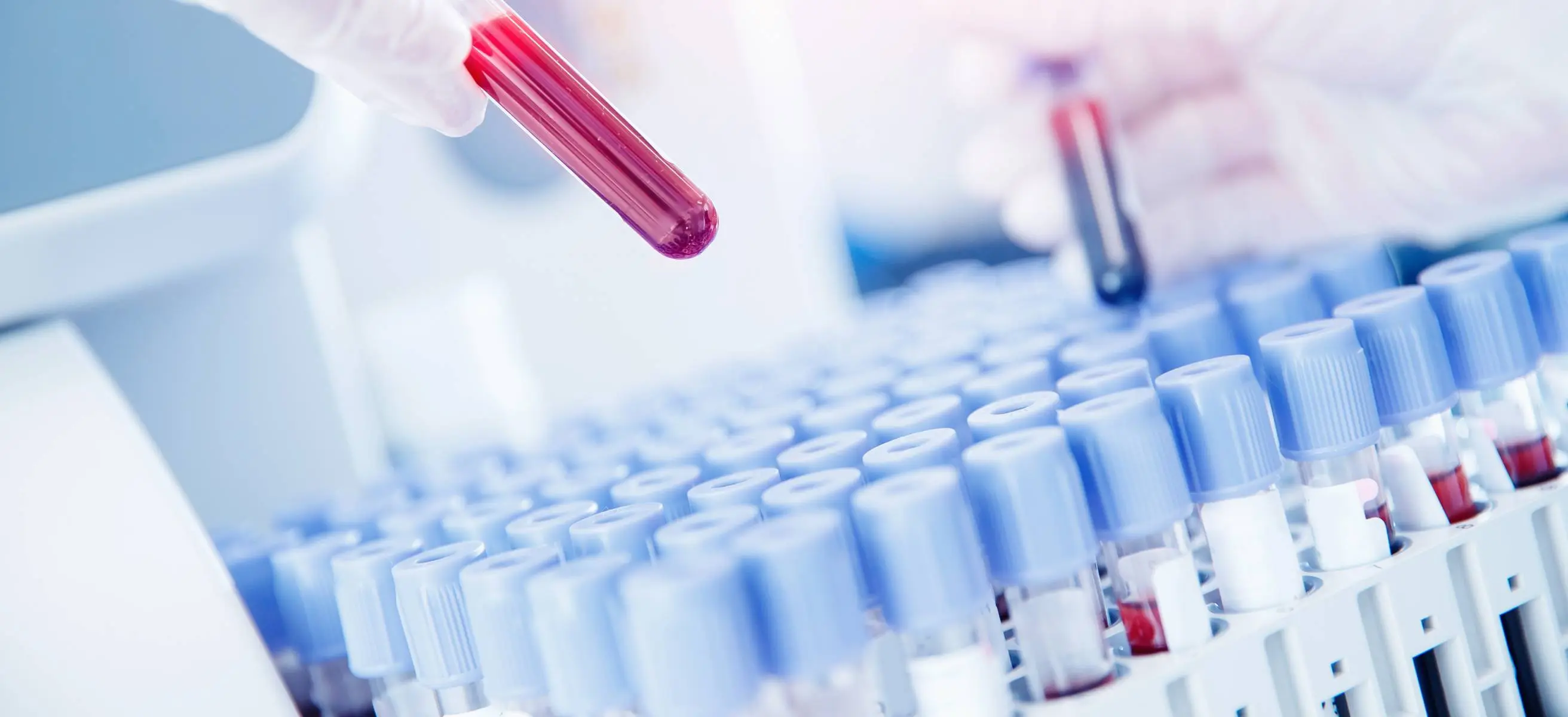 Przygotowanie do badania