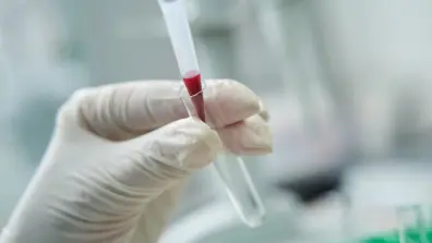 Uzupełnienie diagnostyki