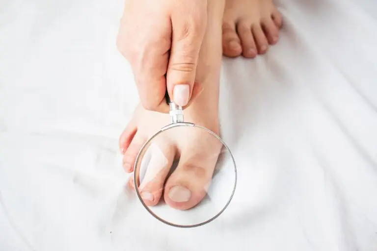 Hiperkeratoza paznokci – czym jest i dlaczego powstaje?