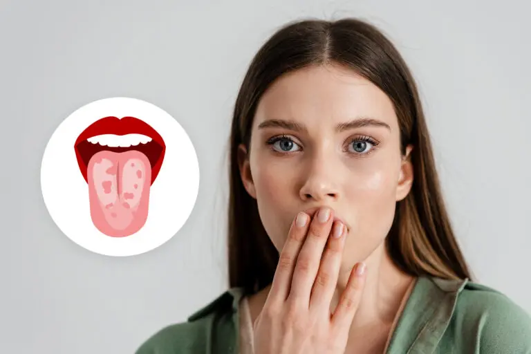 Czym jest język geograficzny? Objawy, przyczyny i leczenie