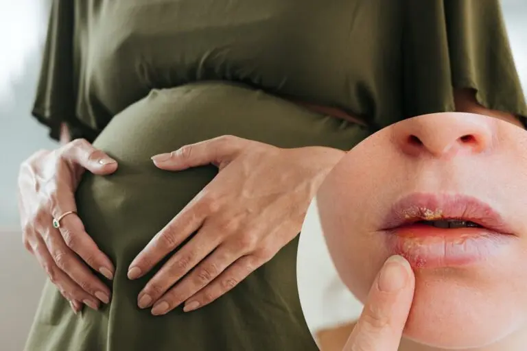 Opryszczka w ciąży – czy jest groźna i jak sobie z nią radzić?