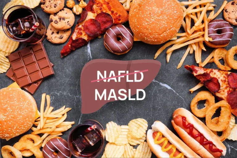 Stłuszczeniowa choroba wątroby związana z zaburzeniami metabolicznymi (MASLD) – dawniej niealkoholowe stłuszczenie wątroby (NAFLD)