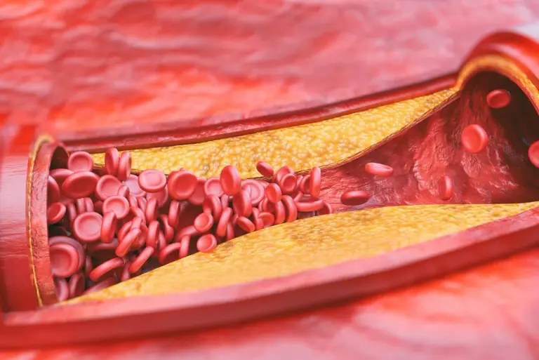 Lipoproteina (a) -  pomijany winowajca w leczeniu miażdżycy cz. 1. Budowa i znaczenie