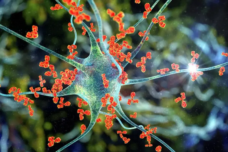 Autoimmunologiczne zapalenie mózgu anty-NMDAR