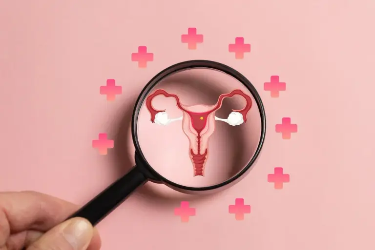 Zespół policystycznych jajników (PCOS) - przyczyny, objawy, diagnostyka, leczenie