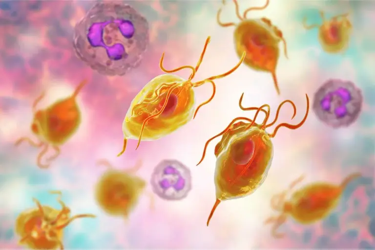 Rzęsistkowica – przyczyny, objawy, diagnostyka, leczenie