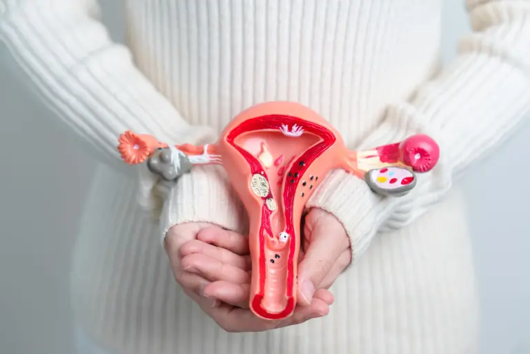 Endometrioza - objawy, diagnoza, leczenie i życie z chorobą