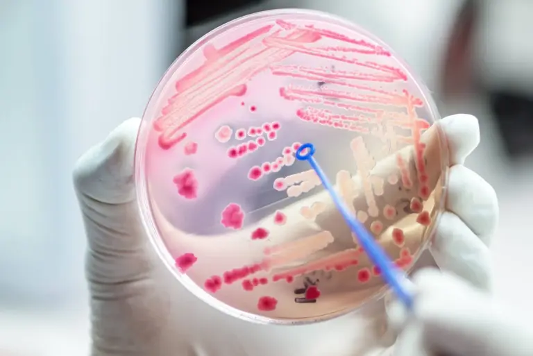 Escherichia coli – bakteria o różnych obliczach