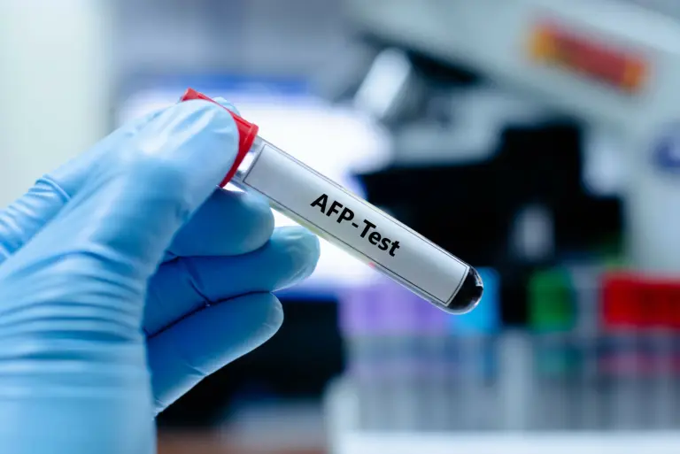 Co to jest alpha-fetoproteina (AFP) i co pozwala wykryć badanie?