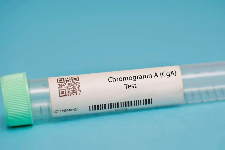 Chromogranina A (CgA) – co to jest? Badanie markeru, wskazania, wyniki