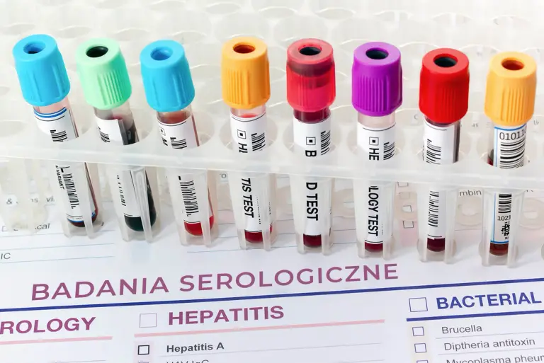 Badania serologiczne – co to jest serologia, na czym polegają badania i kiedy się je wykonuje?