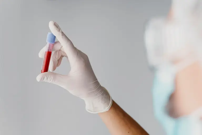 MCHC w morfologii krwi. Co to za wskaźnik, co oznacza niski lub podwyższony poziom?