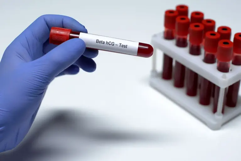 Test ciążowy z krwi. Kiedy i dlaczego przeprowadzić badanie beta hCG?