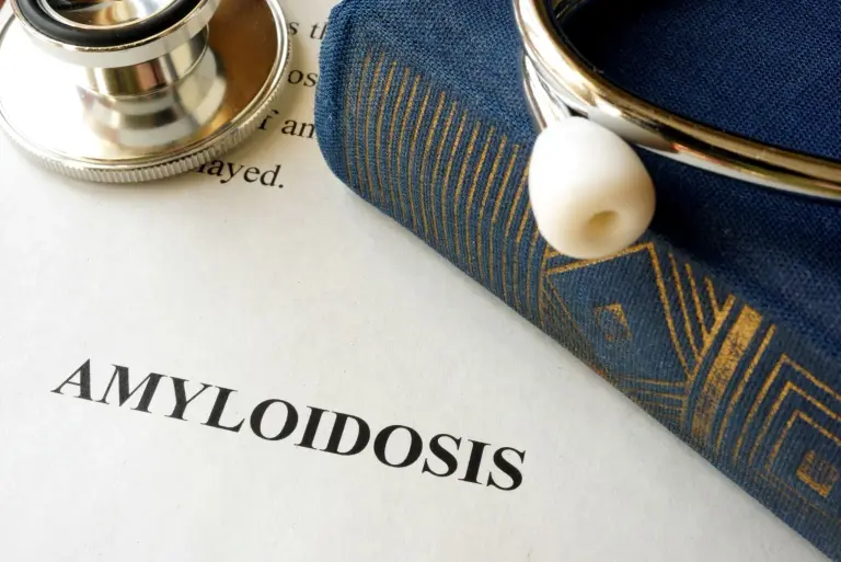 Amyloidoza (skrobiawica) – co to za choroba? Objawy, przyczyny, diagnostyka i leczenie   