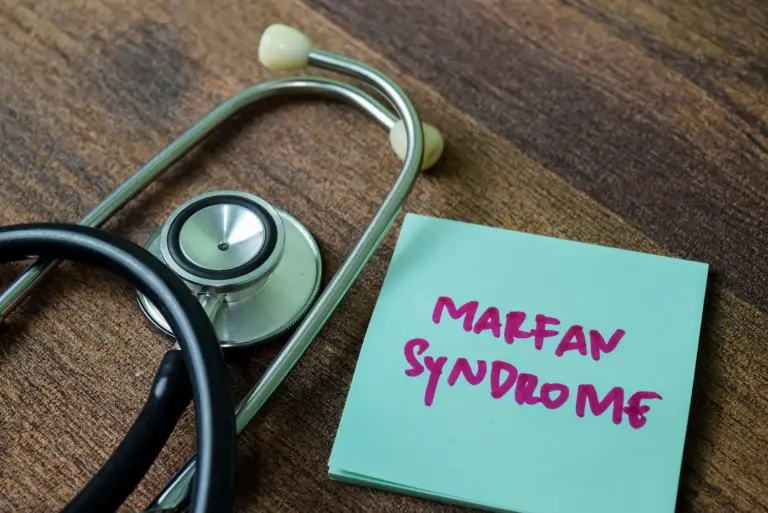 Zespół Marfana: przyczyny, objawy, diagnostyka, leczenie choroby