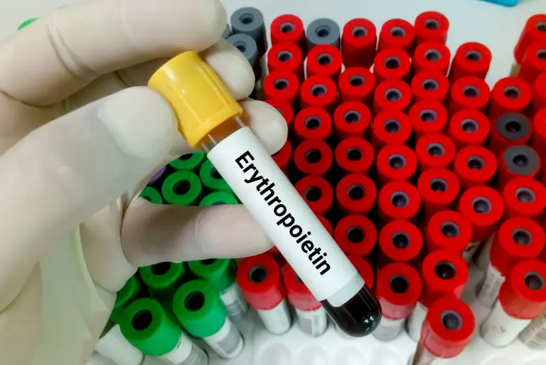 Erytropoetyna – co to jest i po co bada się jej poziom? Interpretacja wyników