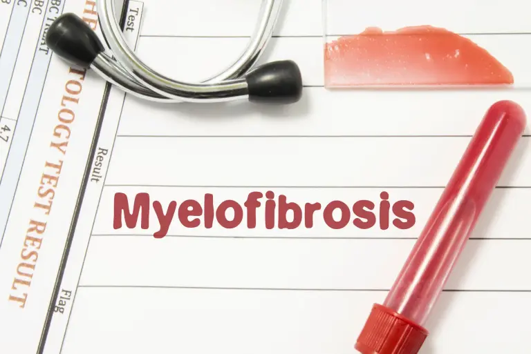 Mielofibroza – co to za choroba? Objawy, diagnostyka, leczenie