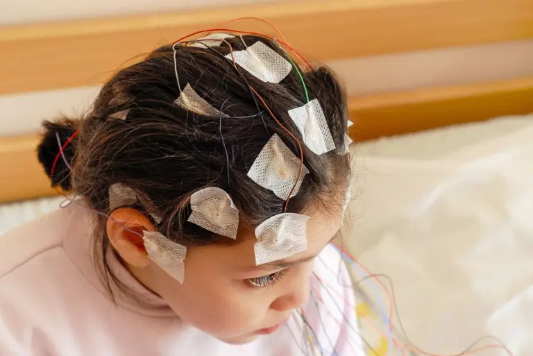 Padaczka u dzieci – objawy, przyczyny, rodzaje, diagnostyka