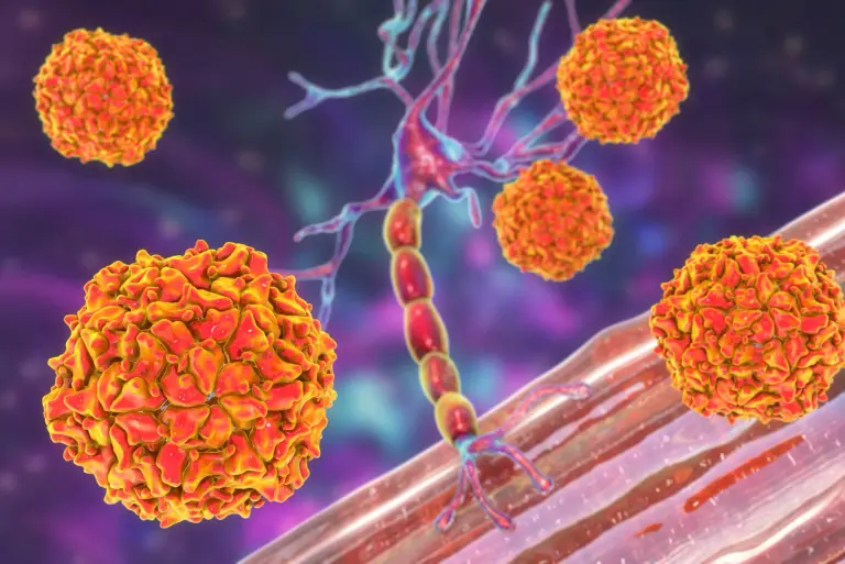 Polio – niemal nieobecna, lecz wciąż groźna choroba