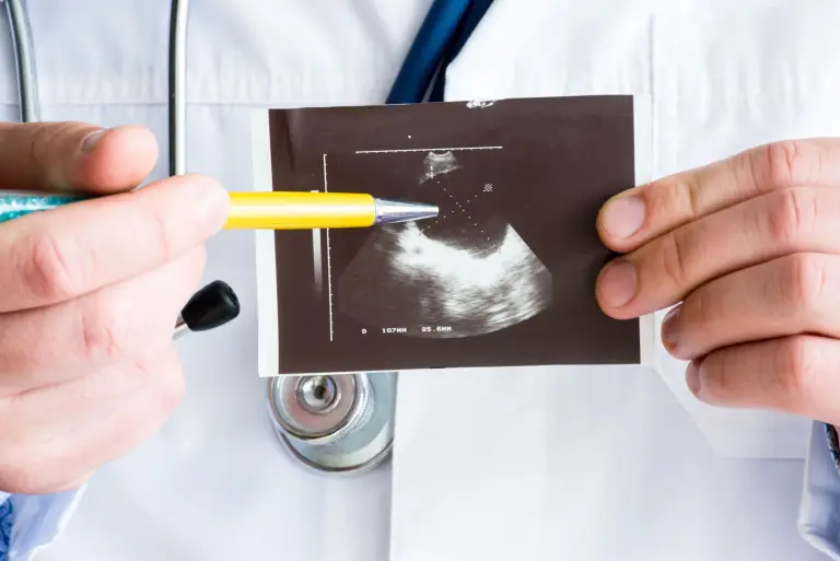Torbiel na trzustce – objawy, przyczyny, diagnostyka i leczenie