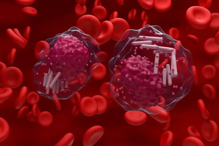 Przewlekła białaczka limfocytowa – objawy, diagnostyka, leczenie