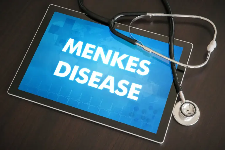 Zespół Menkesa: objawy, przyczyny, diagnostyka i leczenie      