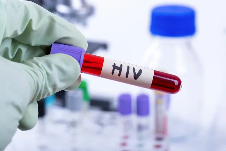 HIV – objawy, drogi zakażenia, diagnostyka i leczenie