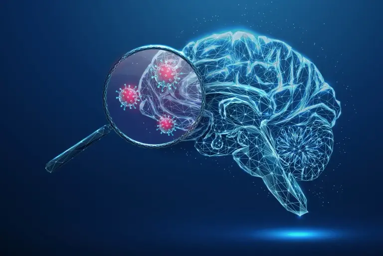 Opryszczkowe zapalenie mózgu – czym jest i jak się objawia? Diagnostyka i leczenie