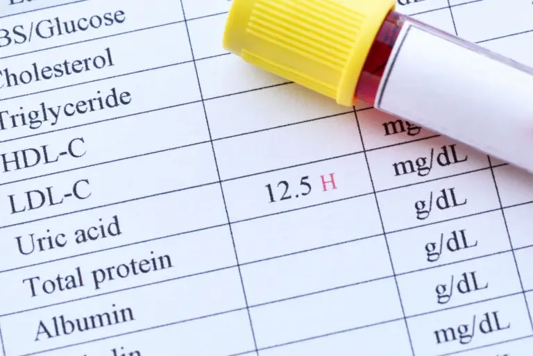 Podwyższony kwas moczowy – objawy, przyczyny i diagnostyka hiperurykemii