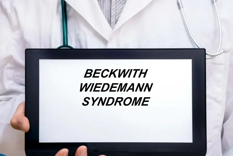 Zespół Beckwitha-Wiedemanna (BWS) – objawy, przyczyny i diagnostyka