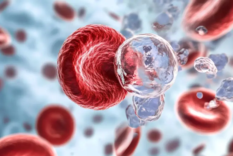 Aplazja szpiku – czym jest i co ją powoduje? Objawy, przyczyny, diagnostyka