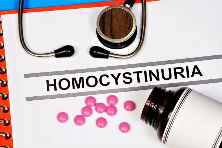 Homocystynuria – co to za choroba i jakie daje objawy? Diagnostyka i leczenie