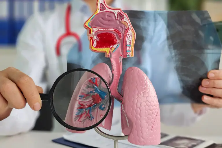 POCHP (przewlekła obturacyjna choroba płuc) – objawy, przyczyny, diagnostyka i leczenie