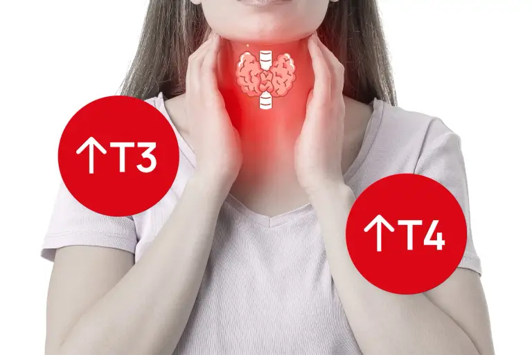 Tyreotoksykoza - przyczyny, objawy, diagnostyka i leczenie