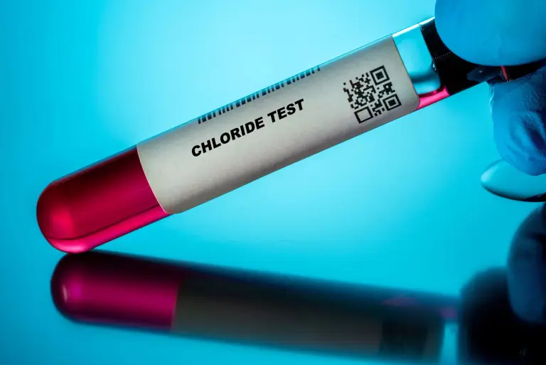 Podwyższone chlorki we krwi (hiperchloremia) – co oznaczają i jak obniżyć ich poziom?