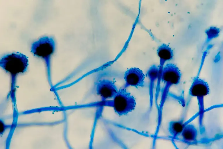 Aspergillus fumigatus – charakterystyka, objawy, badania