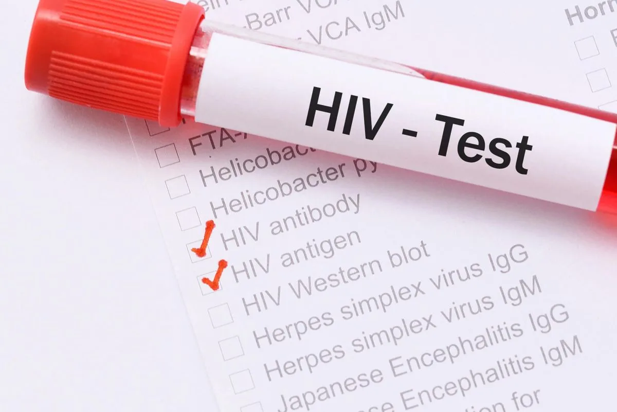 Test na HIV kiedy i kto powinien go wykonać? ALAB laboratoria
