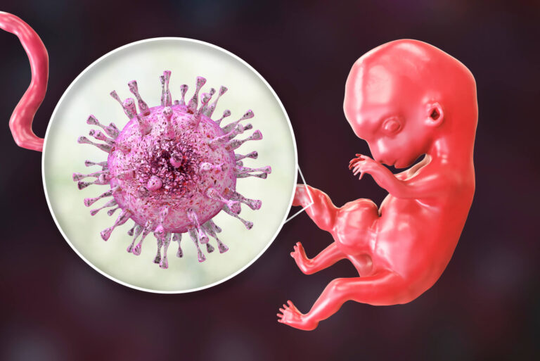Cytomegalia w ciąży – czym grozi? Objawy, przyczyny, diagnostyka