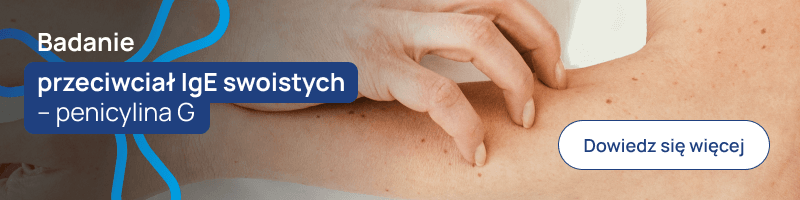 Badanie przeciwciał IgE swoistych – penicylina G banerek
