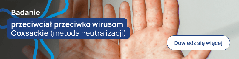 Badanie przeciwciał przeciwko wirusom Coxsackie (metoda neutralizacji) banerek