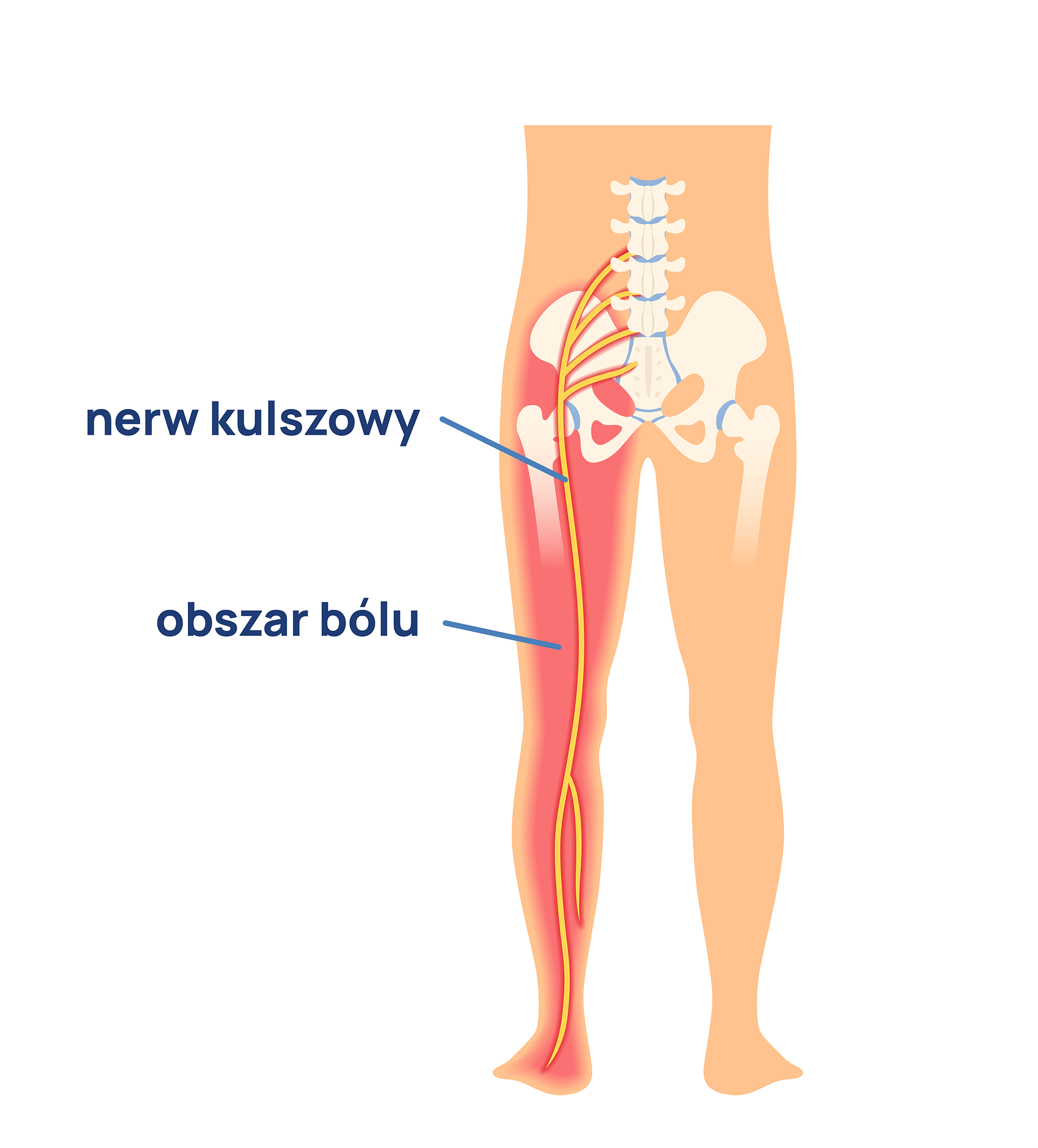 nerw kulszowy infografika