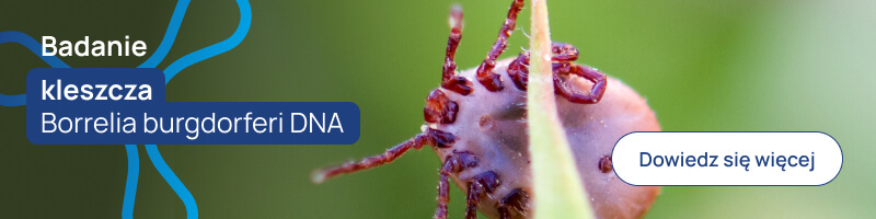 Badanie kleszcza Borrelia burgdorferi DNA banerek
