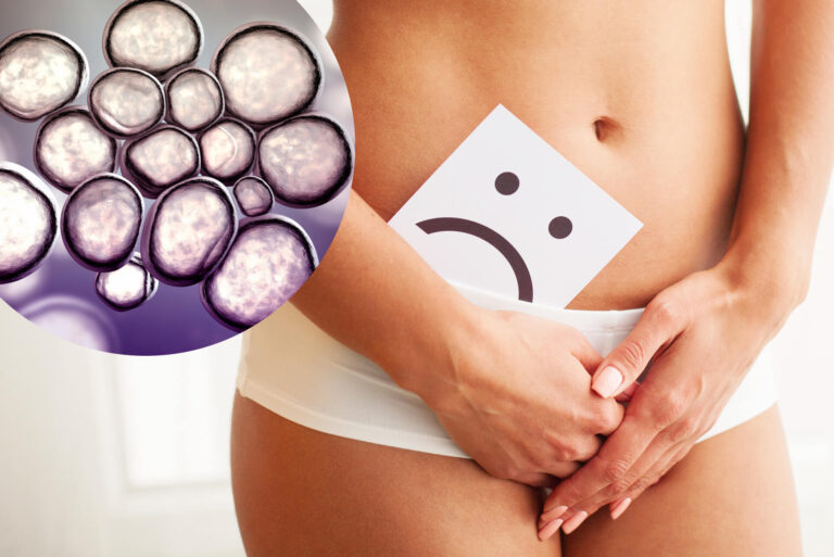 Ureaplasma: ureaplasma urealyticum/parvum – leczenie, objawy i przyczyny. Jak można się zarazić?
