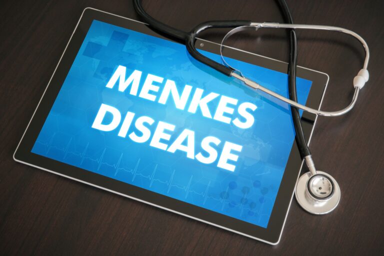 Zespół Menkesa: objawy, przyczyny, diagnostyka i leczenie      